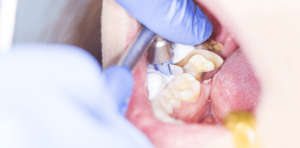 VP Dental |