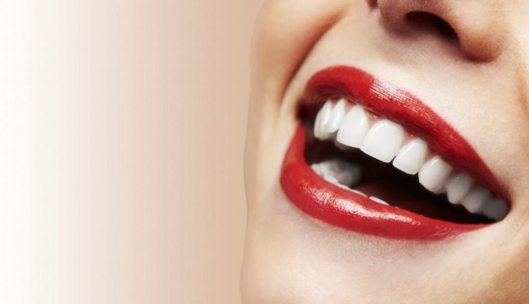 What Can I Eat After Teeth Whitening?