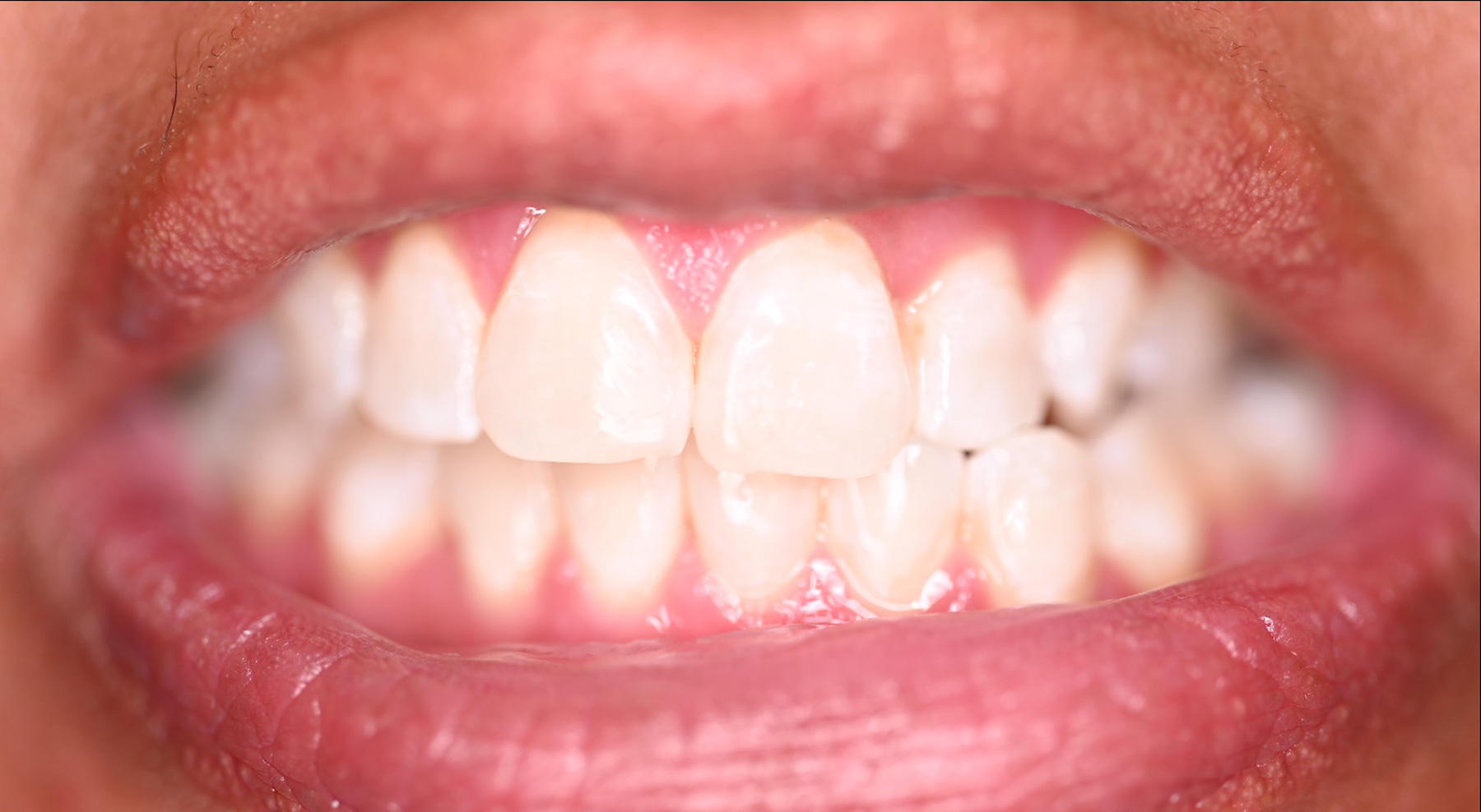 VP Dental | Smile Gallery