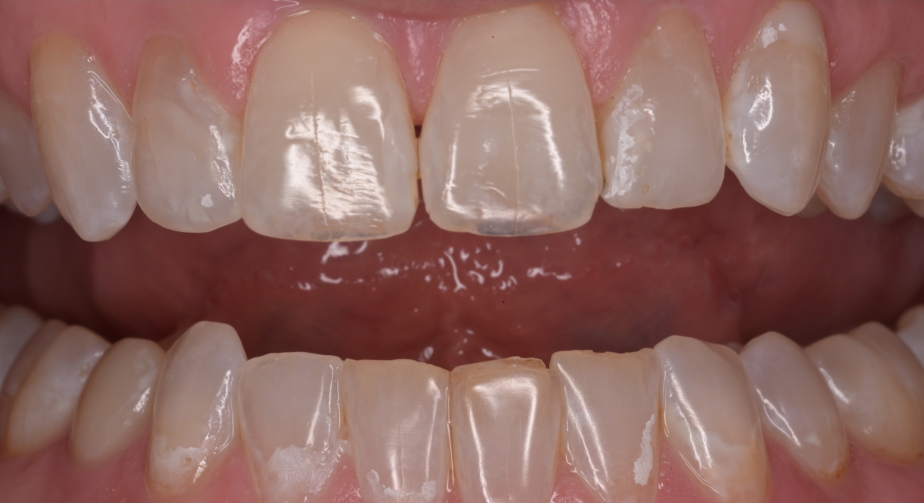 VP Dental | Smile Gallery